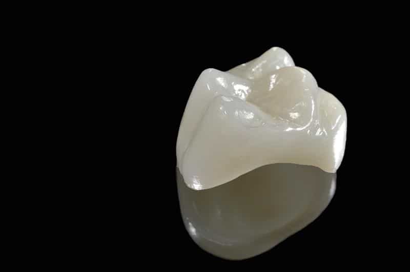 Porcelain Crowns Ocala, FL